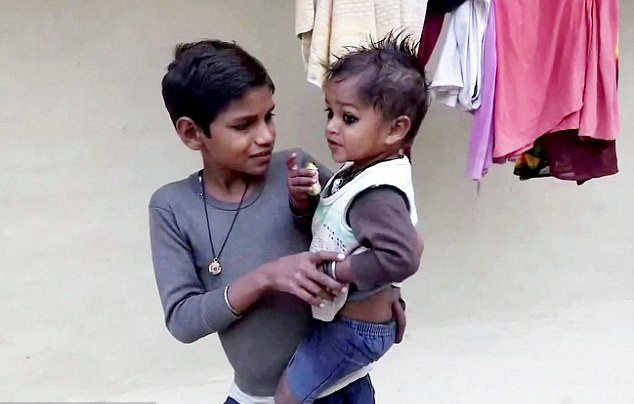 طفل هندي ولد بذيل طوله قدم
