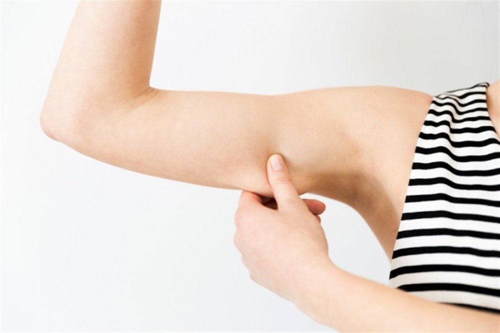  قد تشكل عملية رفع وشد الذراعين بعض الندوب في الجلد
