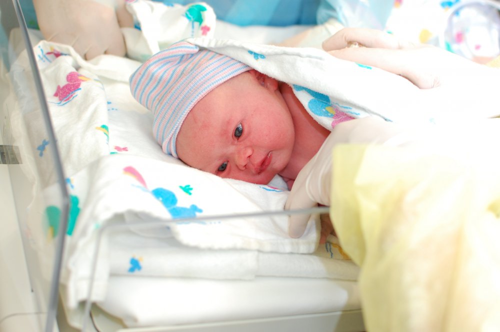 ما هي أعراض متلازمة داون عند الأطفال حديثي الولادة؟