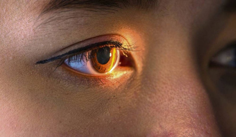 فقدان البصر أو العمى هم من أهم مخاطر عملية تغيير لون العين