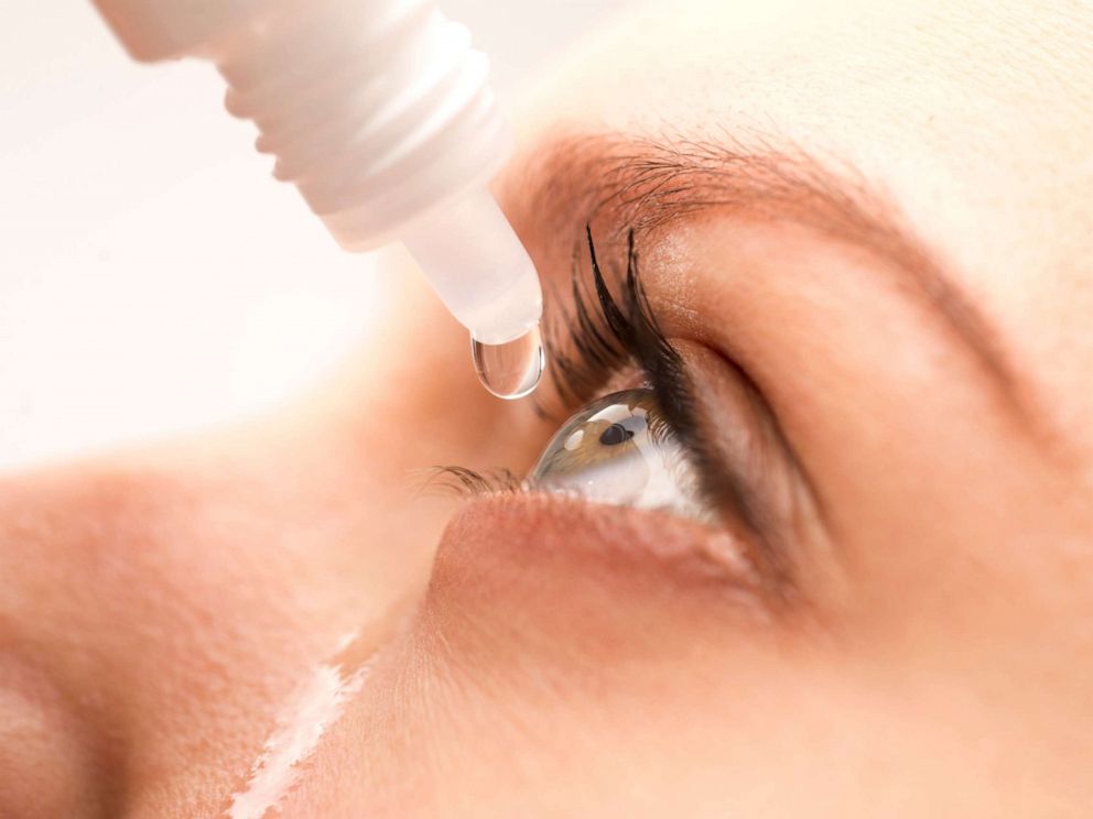 قطرات العيون أحد علاجات مرض الزرق