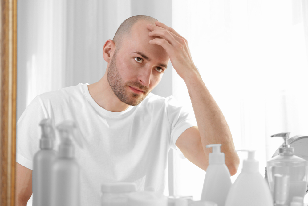 تساقط الشعر ناجم عن نقص عناصر معينة كالفيتامينات أو عوامل مناعية كالثعلبة