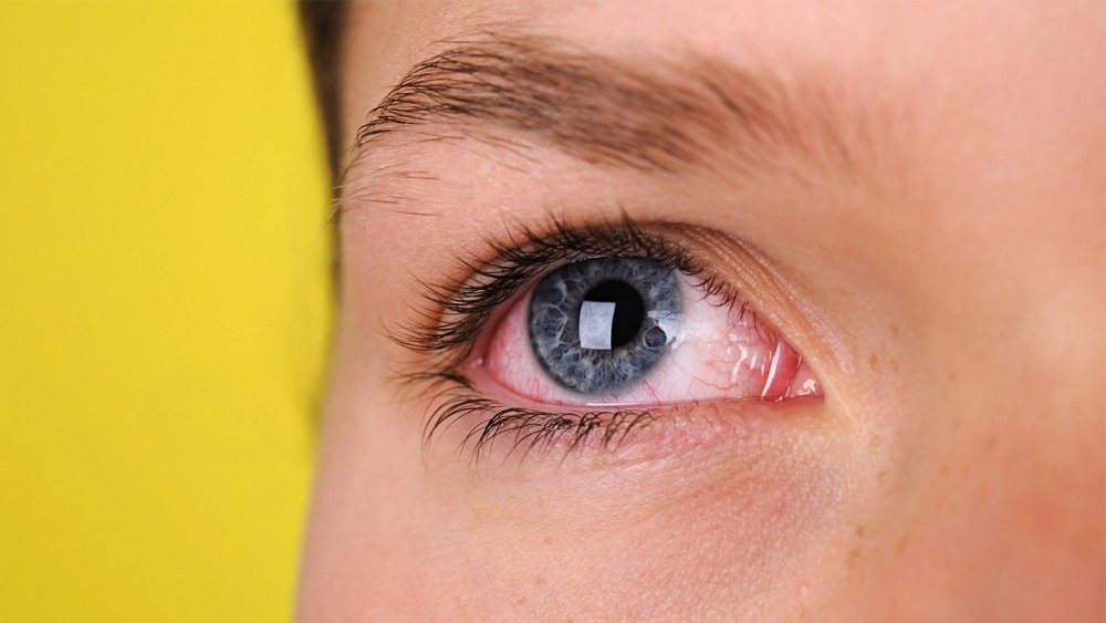  تدابير لمعالجة مشكلة جفاف العين خلال الصيام