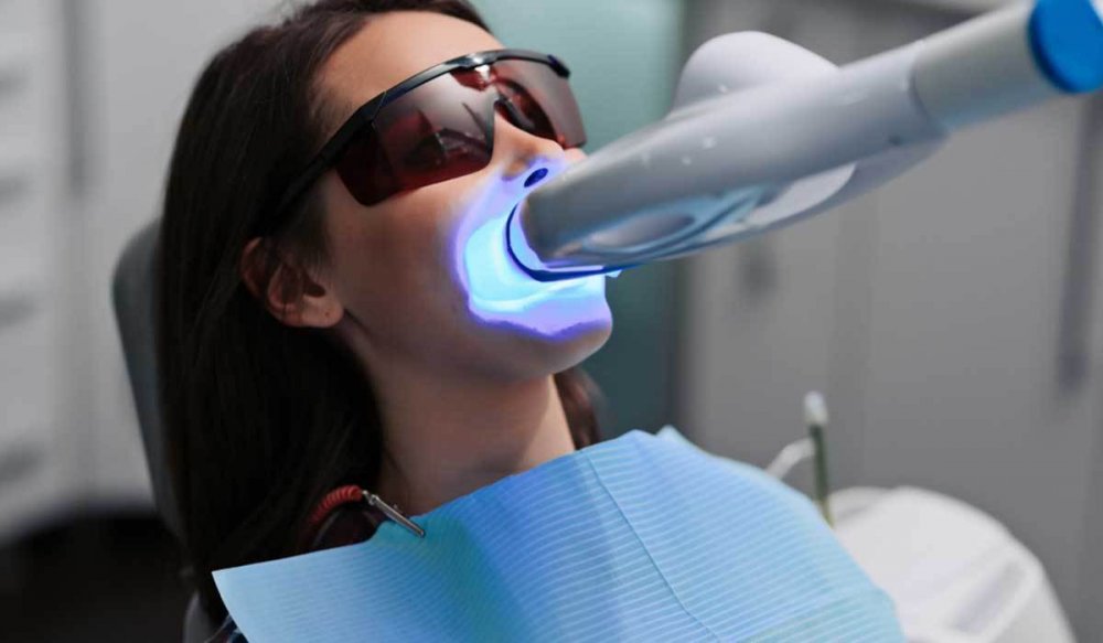 عملية تبييض الأسنان بالليزر تتم من خلال توجيه الحرارة على الأسنان