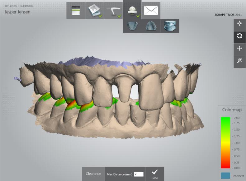 طب الأسنان الرقمي يساعد في توفير التصوير الشعاعي والرقمي للأسنان داخل الفم باستخدام المساحات الضوئية