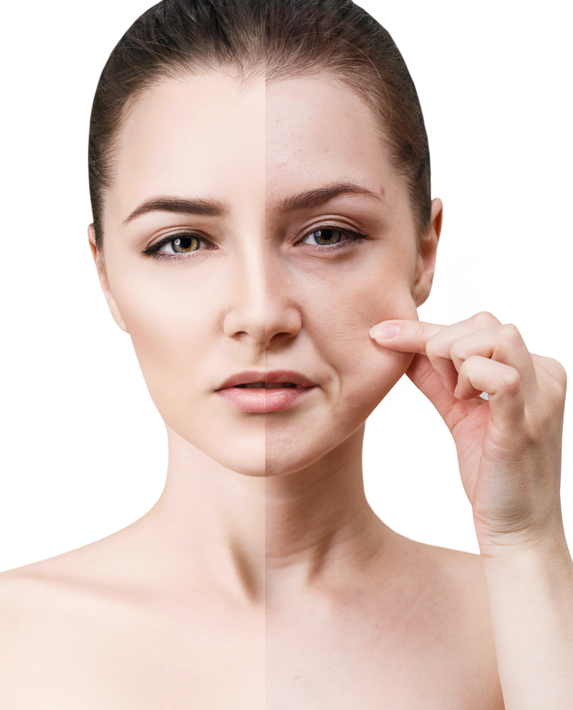  عملية شد الوجه مفيدة في مكافحة علامات الشيخوخة في الوجه والرقبة