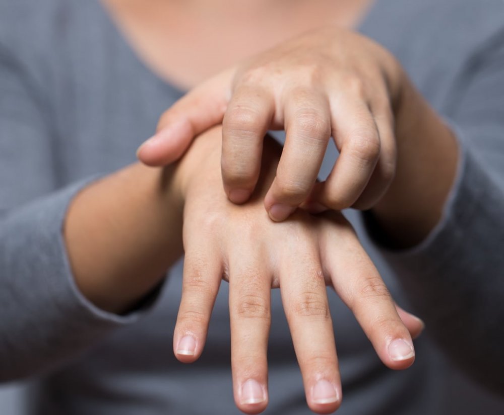 الحكة من أعراض الأكزيما في اليد