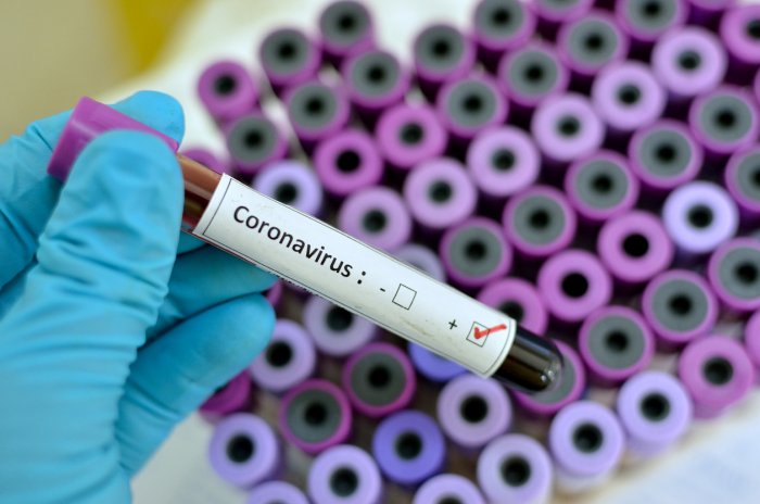 فيروس كورونا لم يتحول إلى وباء حسب منظمة الصحة العالمية