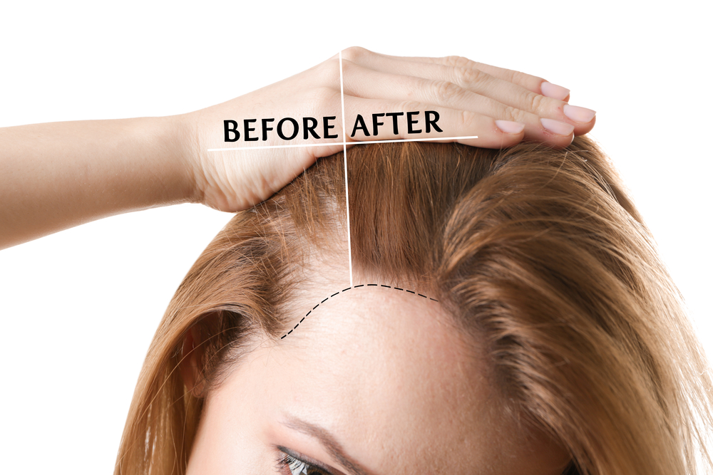 Zalety kolendry w pielęgnacji włosów i jak jej używać